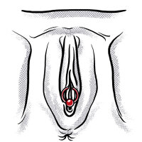 Hymen Piercing